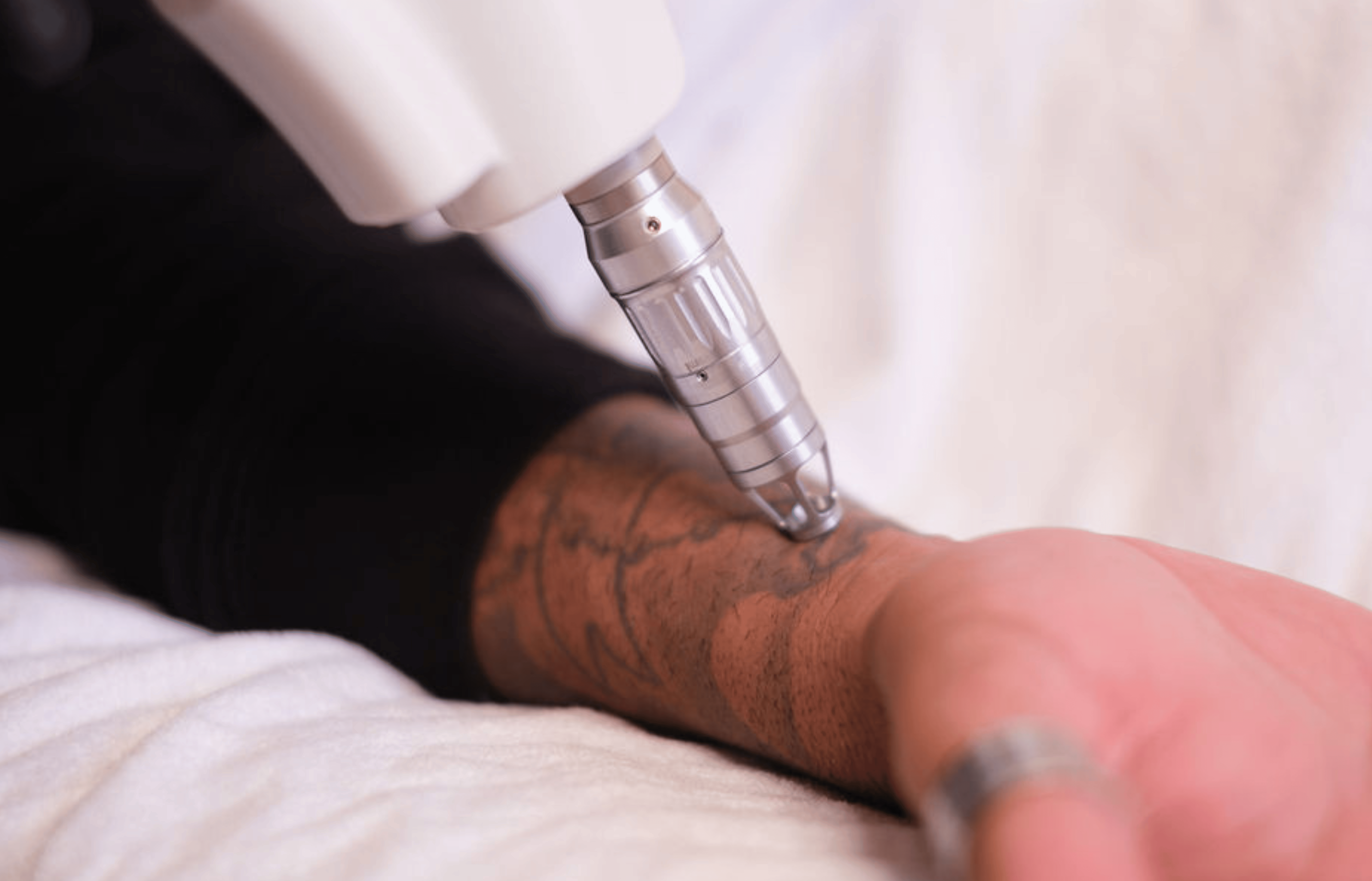 Face and Body Inc — laser tattoo removal clinic in East Perth
