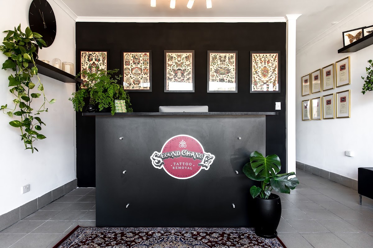 Second Chance Tattoo Removal — laser tattoo removal clinic in Adelaide