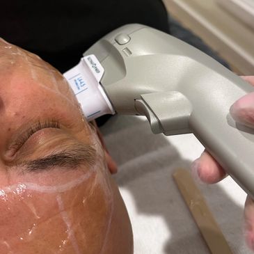 Precision Hair Skin Brow Treatments β laser tattoo removal clinic in Officer