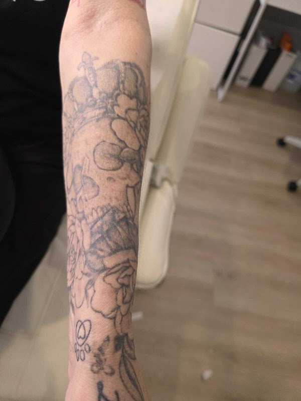 Laser Lounge Perth β laser tattoo removal clinic in Ellenbrook