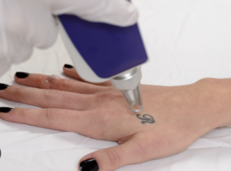 Glasglow Skin Clinic — laser tattoo removal clinic in Joondalup