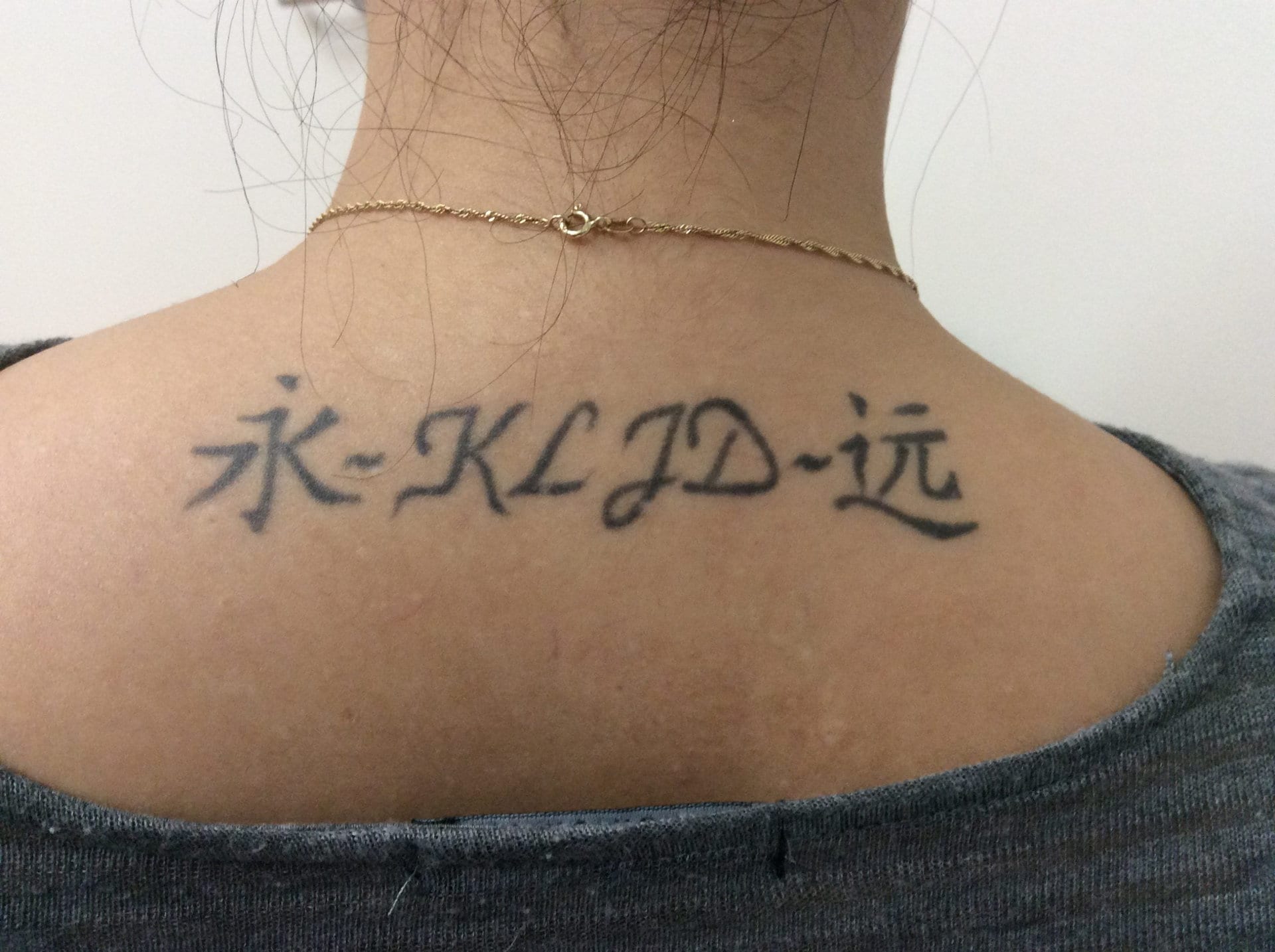 Victorian Cosmetic Dermal Clinics Frankston — laser tattoo removal clinic in Frankston