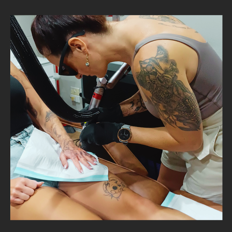 Revival Laser Clinic β laser tattoo removal clinic in Caloundra