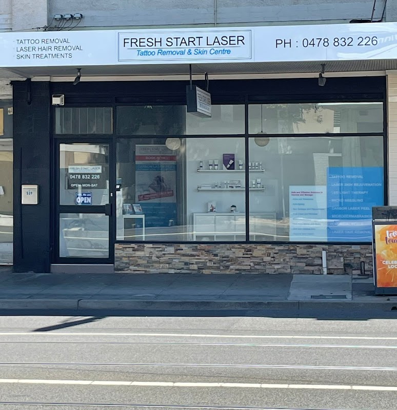 Fresh Start Laser Skin Care Clinic - Laser Tattoo Removal, Laser Hair Removal & Skin Care Services Melbourne — laser tattoo removal clinic in Preston