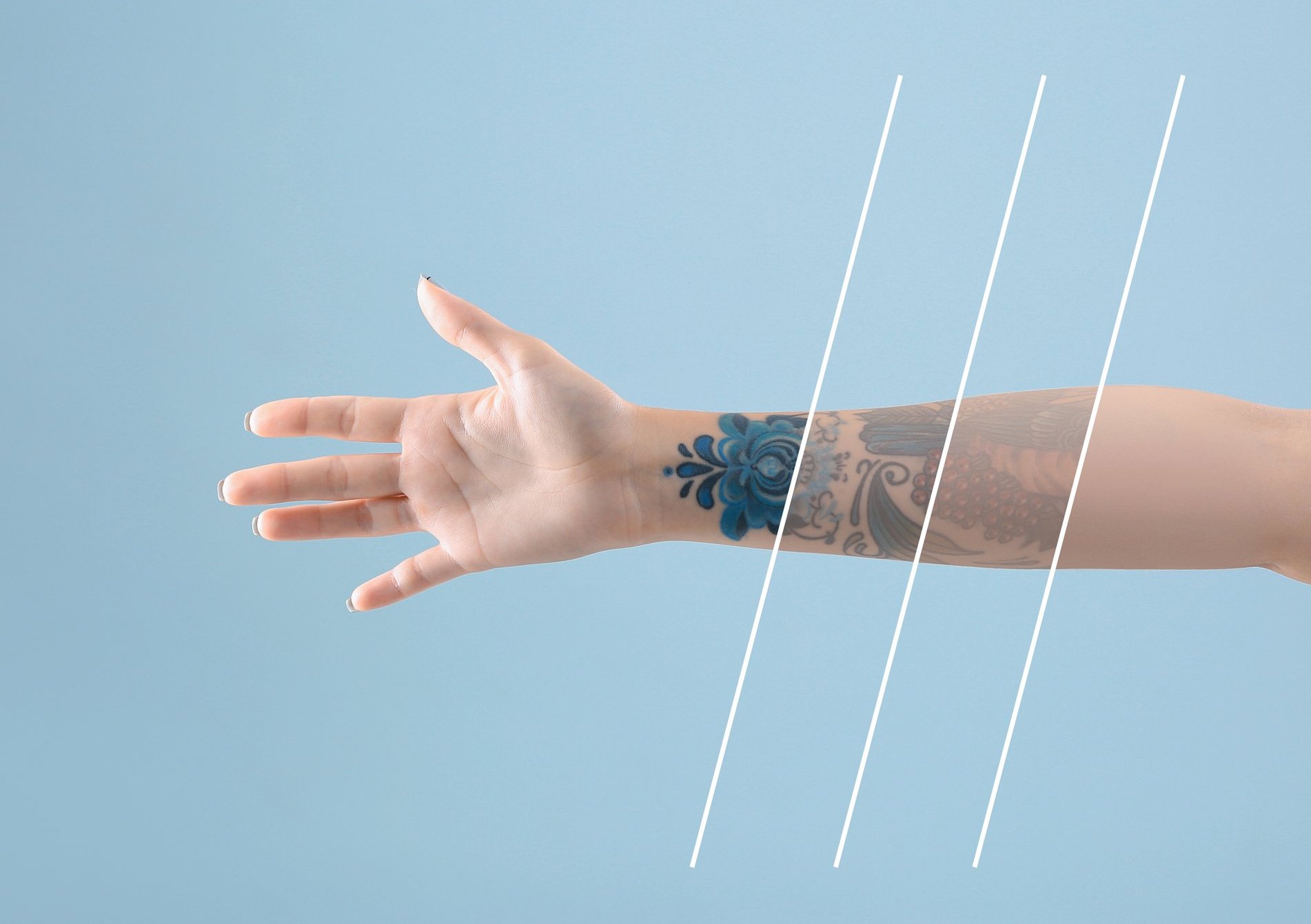 Skin Xclusive — laser tattoo removal clinic in South Yarra
