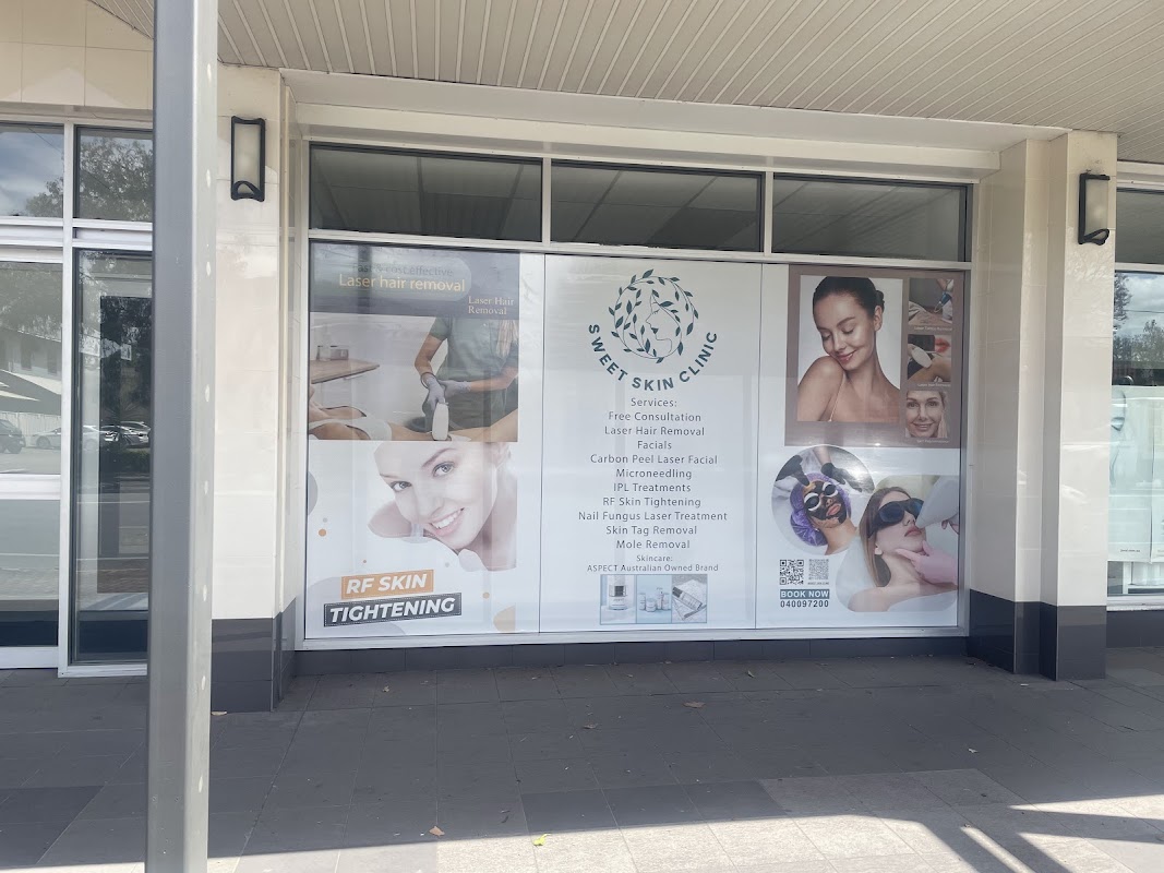 Sweet Skin Clinic — laser tattoo removal clinic in Royston Park