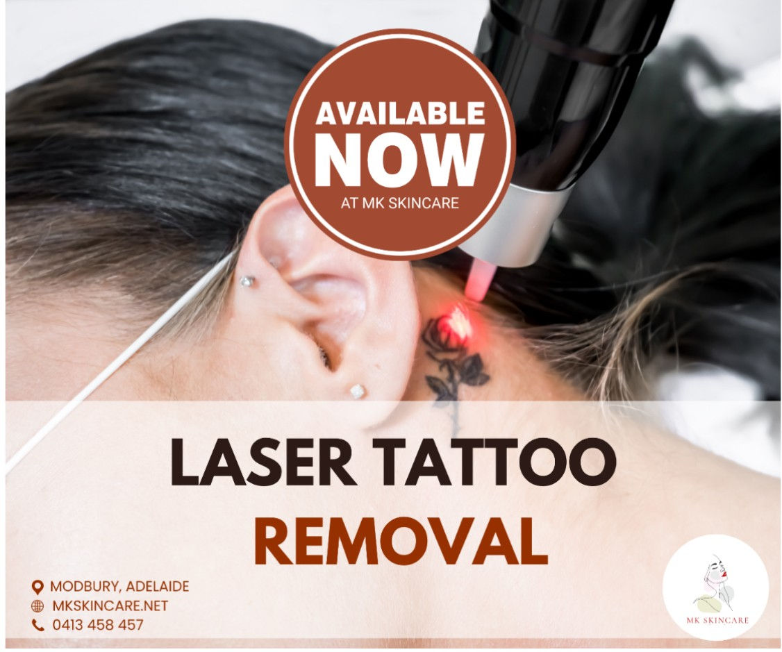 MK Skincare — laser tattoo removal clinic in Modbury Heights