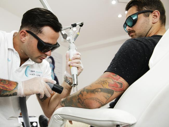 Think Again Laser Clinic - Rozelle โ laser tattoo removal clinic in Rozelle