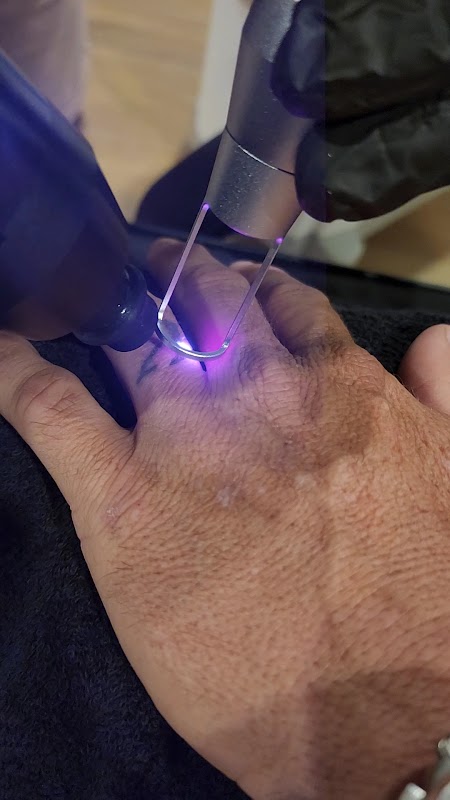 Ink Ragrets β laser tattoo removal clinic in Maroochydore