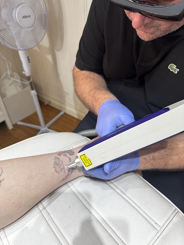 Really Good Tattoo Removal — laser tattoo removal clinic in Sandgate