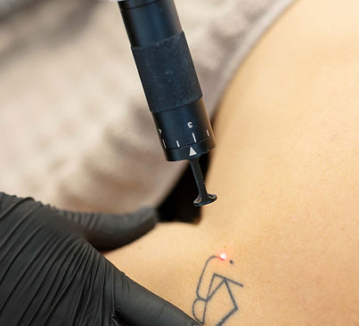 Jia Jia Body & Skin Clinic — laser tattoo removal clinic in Ryde