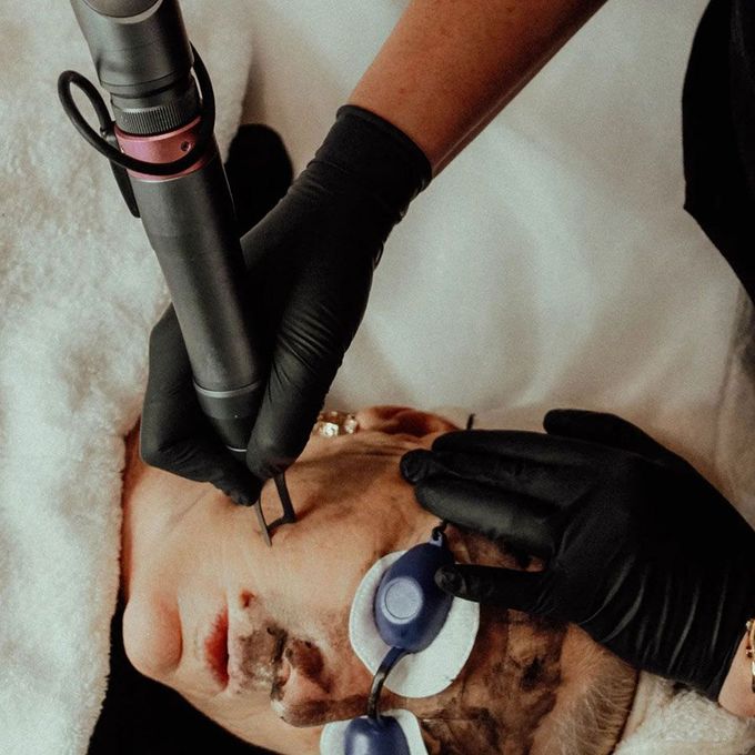 Beauty & Laser by Sarah — laser tattoo removal clinic in Long Jetty