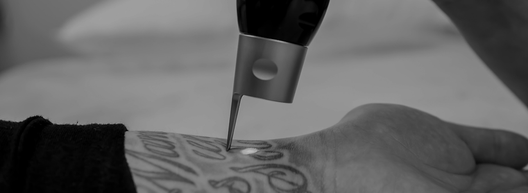 Bare Again Tattoo Removal — laser tattoo removal clinic in Chelsea