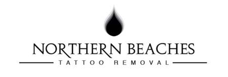 Northern Beaches Tattoo Removal β laser tattoo removal clinic in Avalon Beach