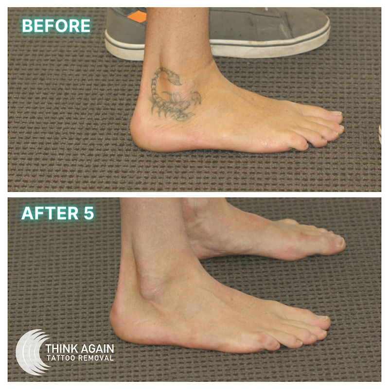 Think Again Laser Clinic - Dee Why â laser tattoo removal clinic in Dee Why
