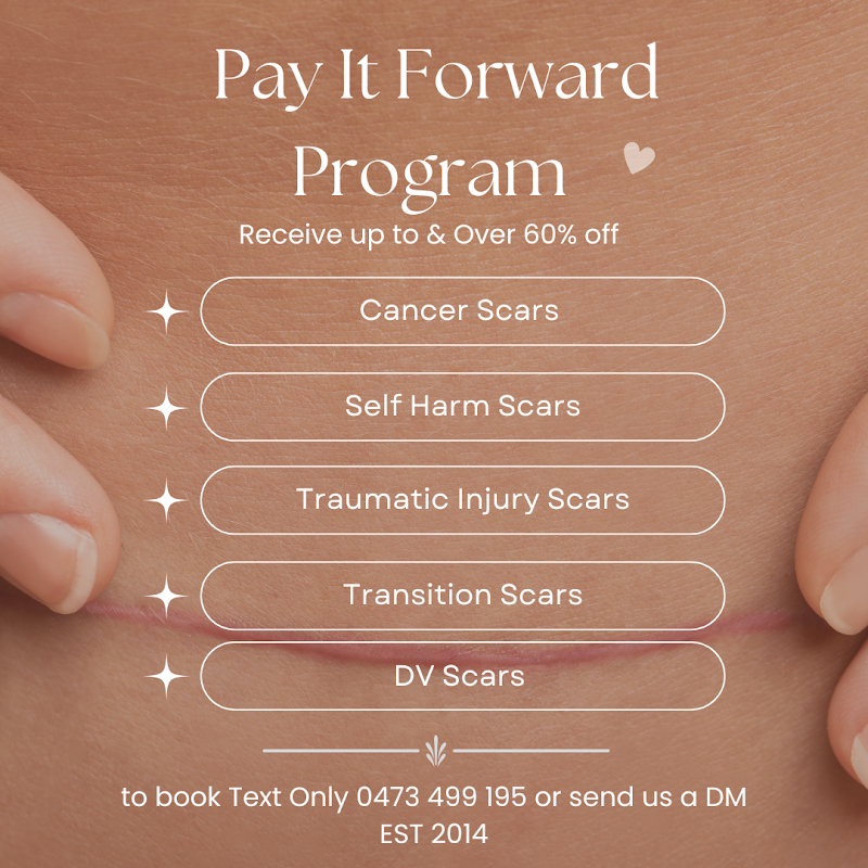 Scar Treatment Perth — laser tattoo removal clinic in Dianella