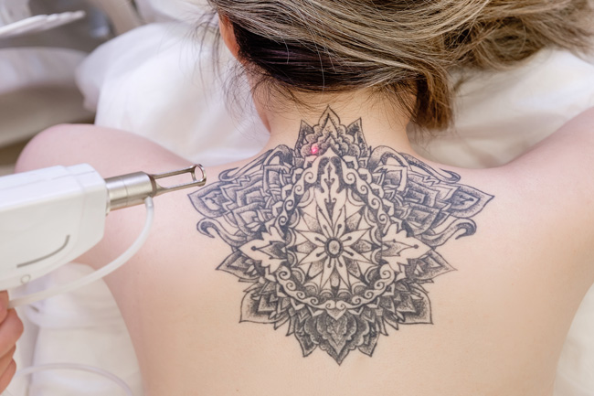 Laser You β laser tattoo removal clinic in Daw Park