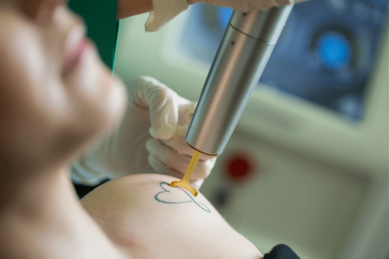 Dingley Mary E — laser tattoo removal clinic in Toowong