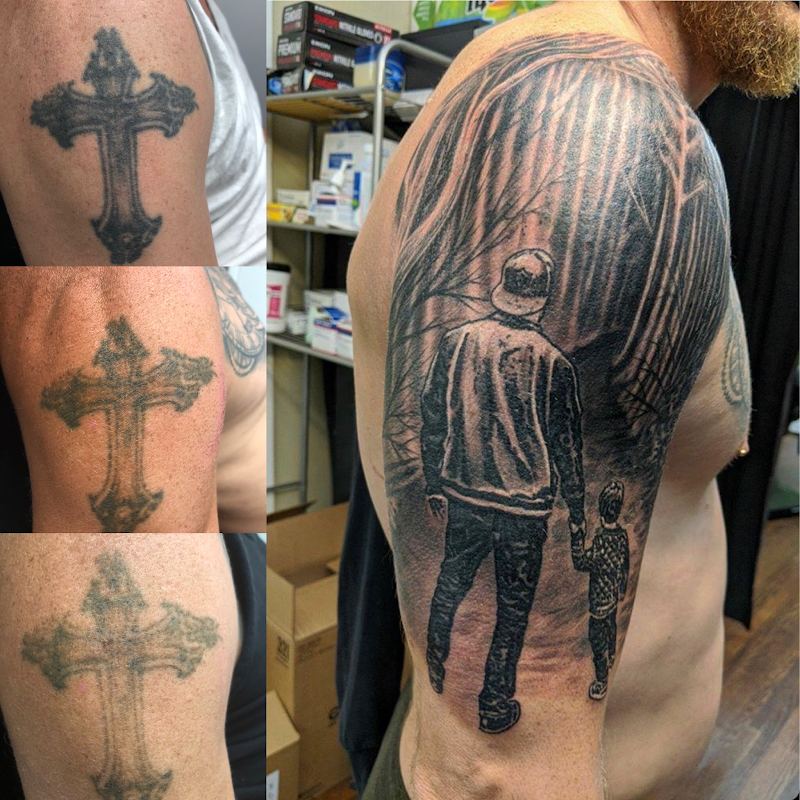 Laser Away Ink — laser tattoo removal clinic in Cambridge