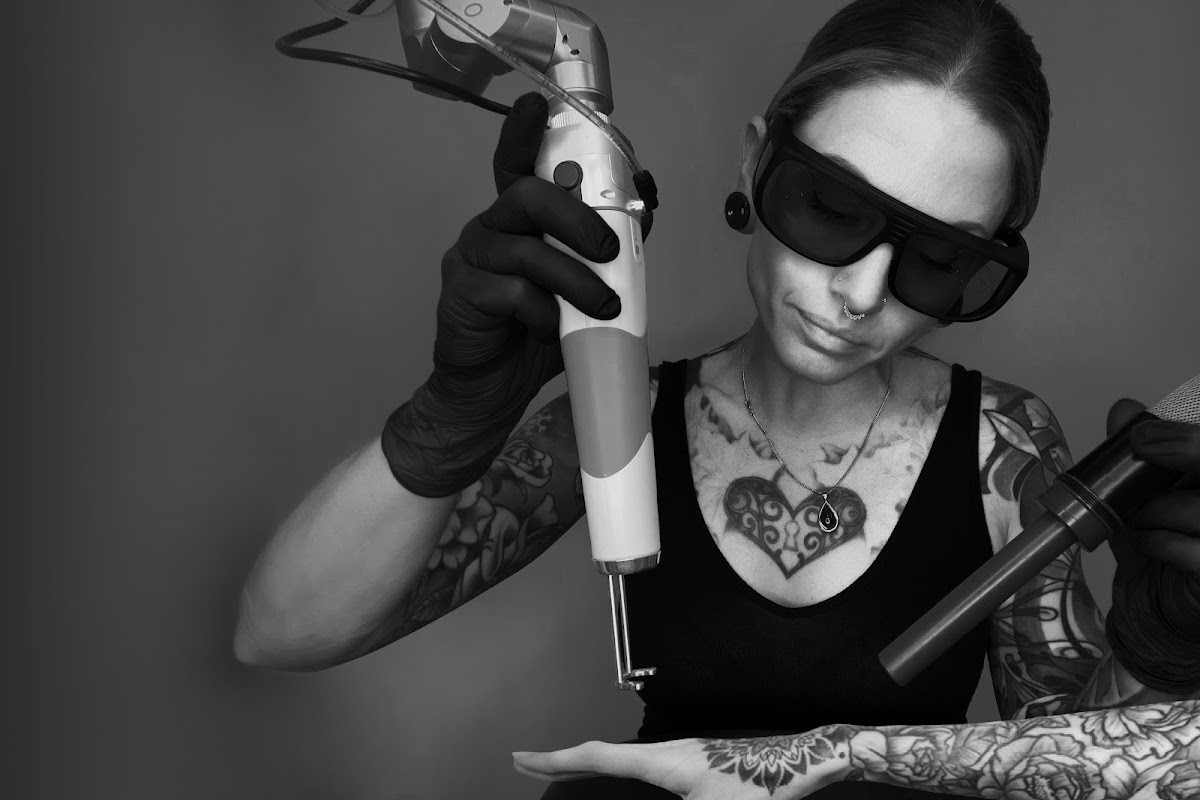 Empire Détatouage — laser tattoo removal clinic in Québec City