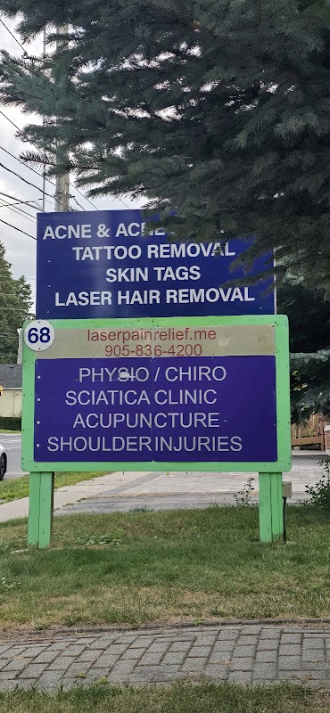 Laser Tattoo Removal — laser tattoo removal clinic in Newmarket