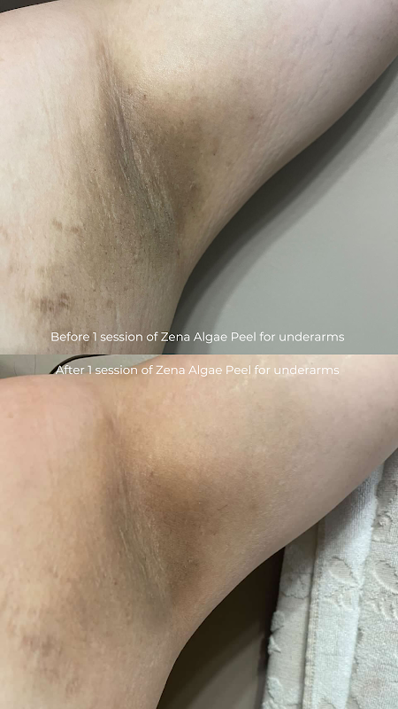 Dear Me, Take Care | Winnipeg Facials & Laser — laser tattoo removal clinic in Winnipeg
