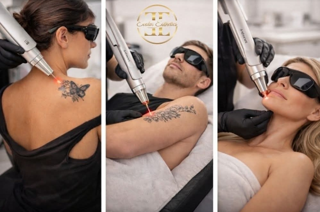 Evolve Esthetics Kelowna β laser tattoo removal clinic in Kelowna