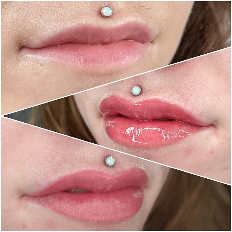 Blade & Bow — laser tattoo removal clinic in Victoria