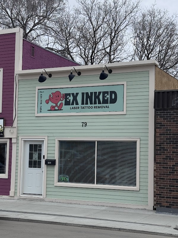 Ex Inked Laser Tattoo Removal — laser tattoo removal clinic in Winnipeg
