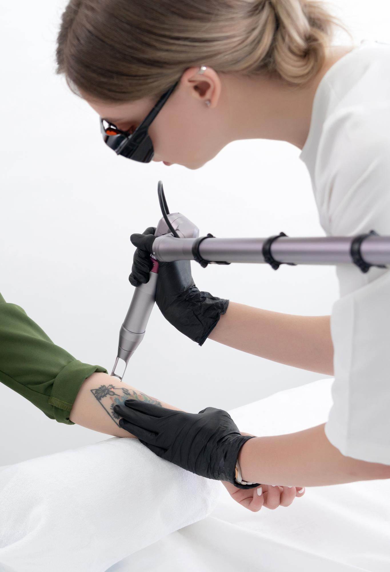 Tattoo Time Machine Laser Clinic โ laser tattoo removal clinic in Winnipeg
