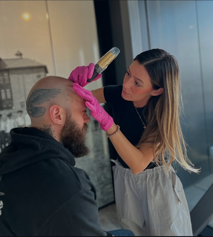 YYC Scalp Micropigmentation (SMP) — laser tattoo removal clinic in Calgary