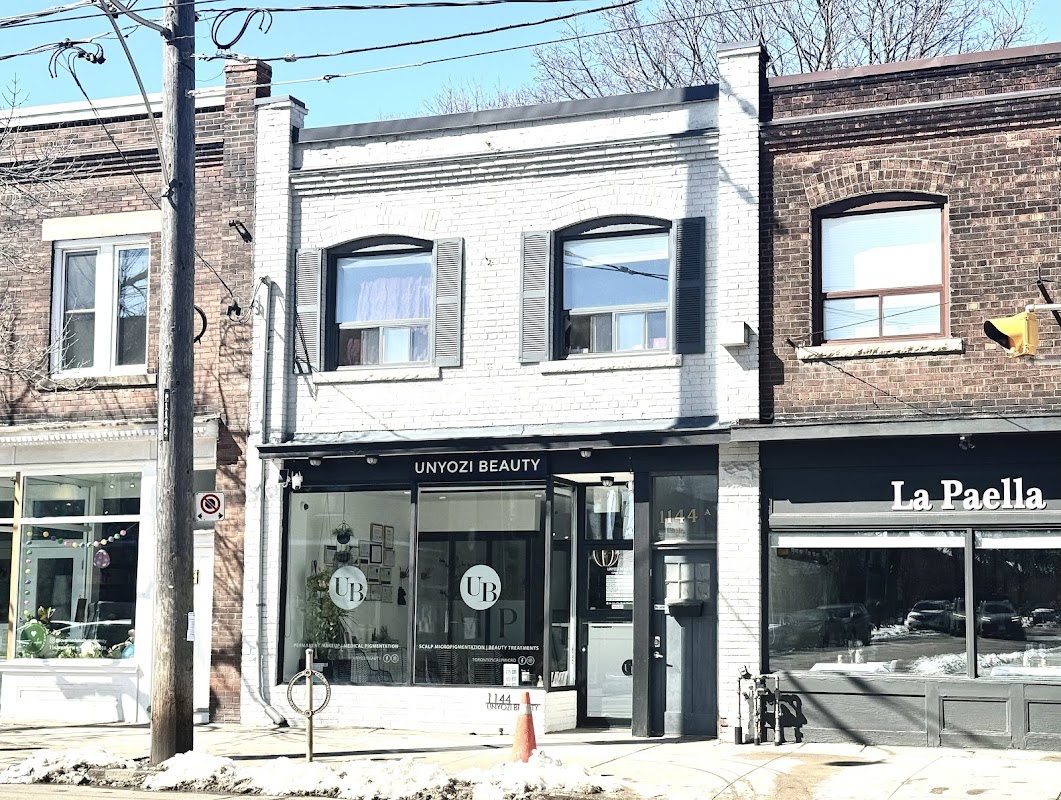 Unyozi Beauty-Permanent Makeup & Scalp Micropigmentation — laser tattoo removal clinic in Toronto