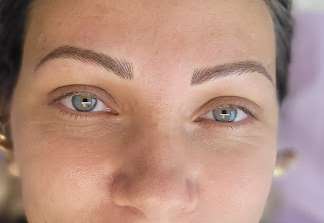 Hamilton Brows — laser tattoo removal clinic in Stoney Creek
