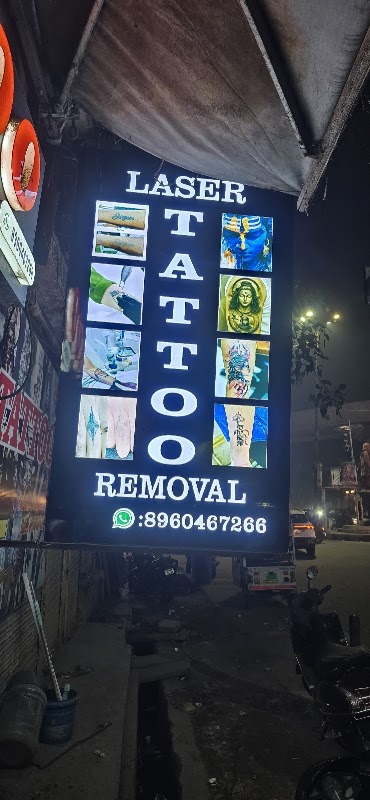 Tattoo Laser Removal — laser tattoo removal clinic in Lucknow
