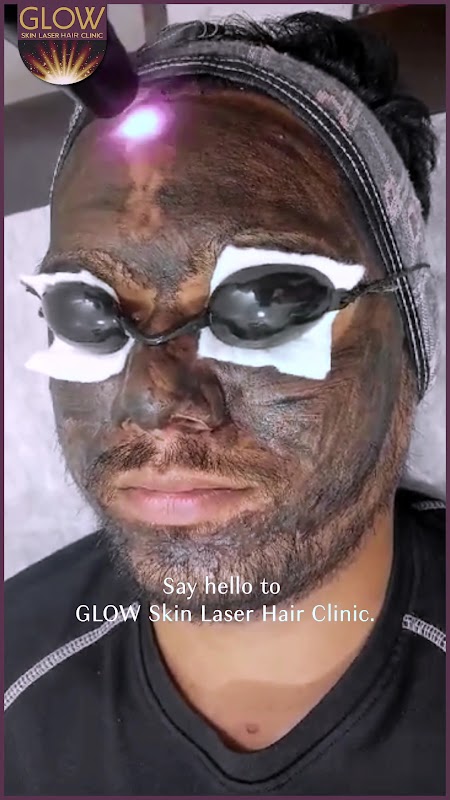 Glow Skin Laser Hair Clinic | Laser Hair Reduction in Baner — laser tattoo removal clinic in Pune