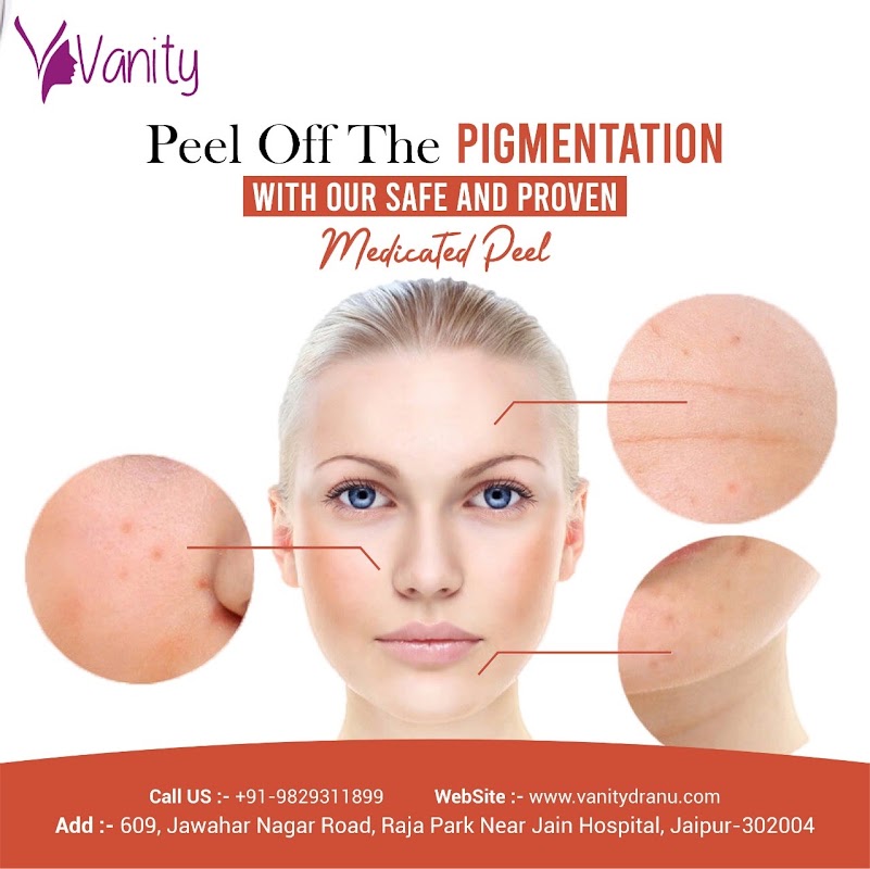 Vanity laser clinic — laser tattoo removal clinic in Jaipur