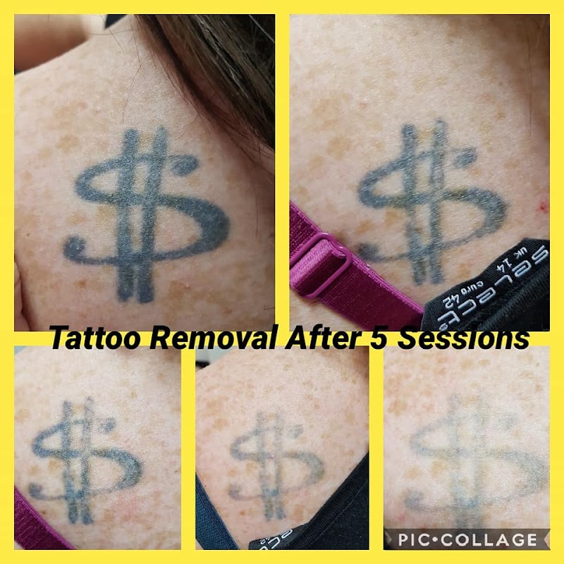 K J Beauty, Aesthetics and Training — laser tattoo removal clinic in Whangārei