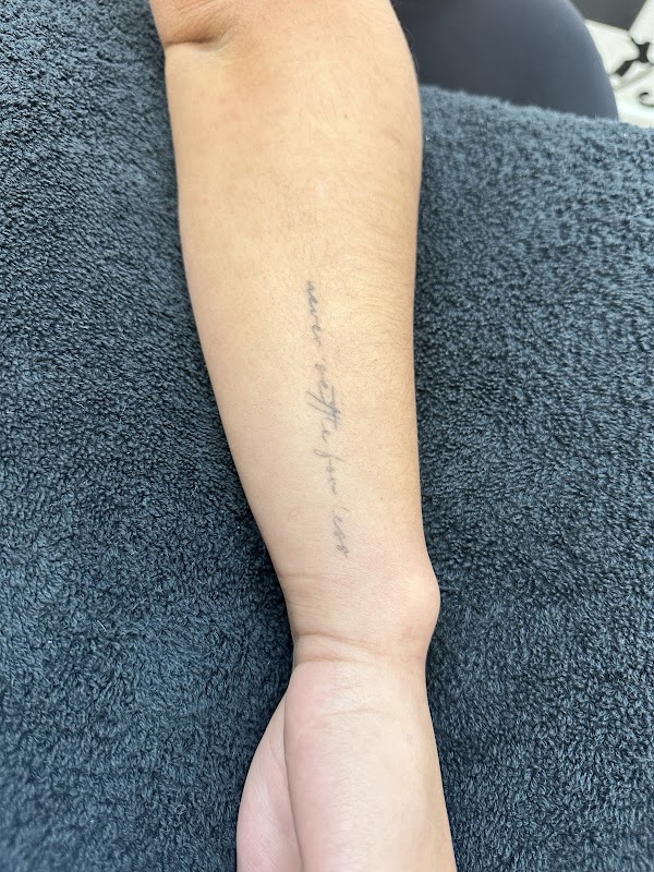 HB LASER TATTOO REMOVAL — laser tattoo removal clinic in Hawke's Bay
