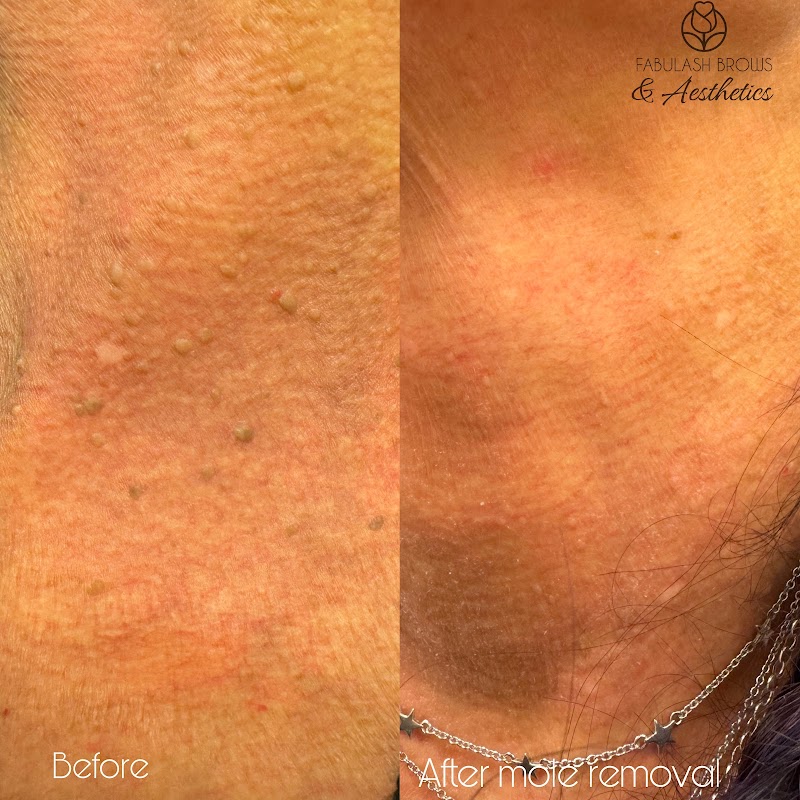 Fabulash Brows & Aesthetics — laser tattoo removal clinic in Te Aro