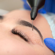 Rejuve Skin β laser tattoo removal clinic in Blenheim Central