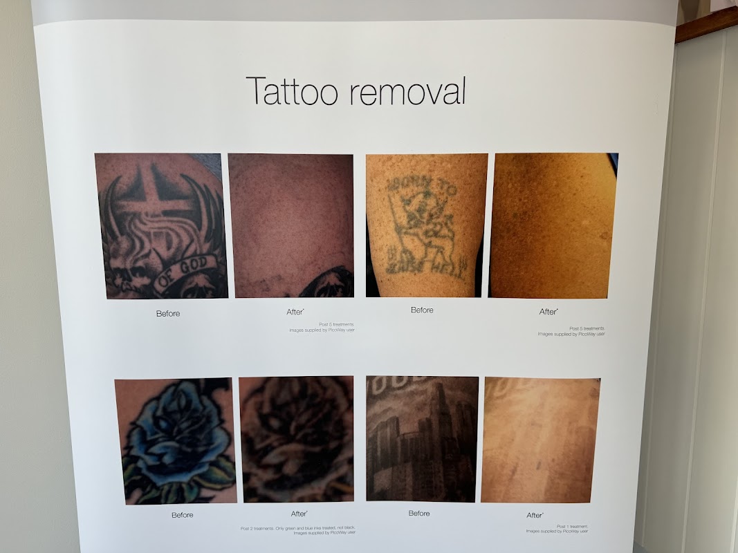 Good Day Skin Solutions — laser tattoo removal clinic in Birkenhead