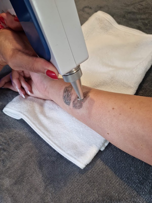 The Dunes Skin and Laser — laser tattoo removal clinic in Papamoa Beach