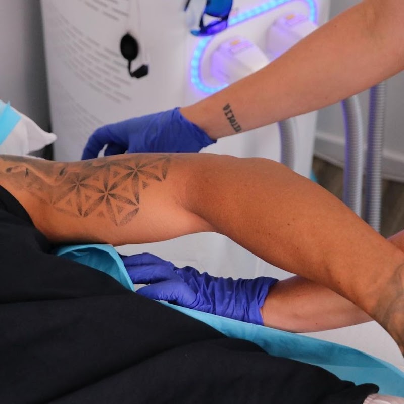 Found Skin — laser tattoo removal clinic in Mount Maunganui