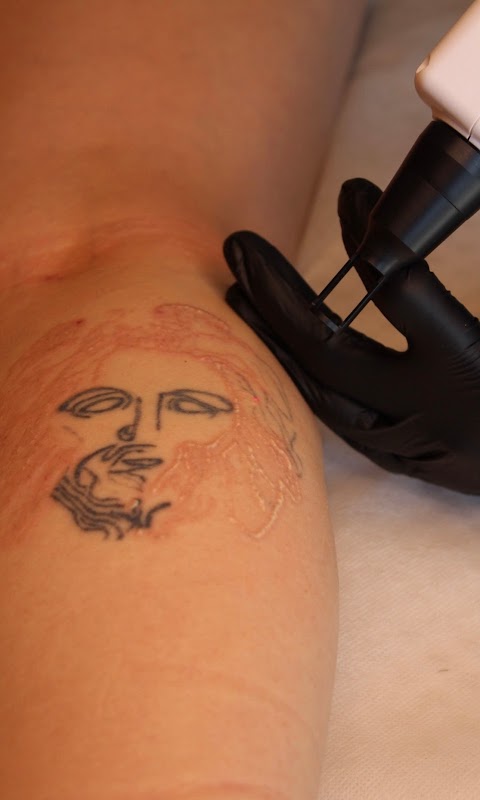 The Cabin Tattoo Removal & Beauty — laser tattoo removal clinic in Papamoa Beach