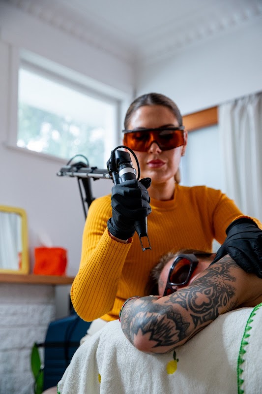 Fade - The Skin Laser Lab — laser tattoo removal clinic in Mount Maunganui