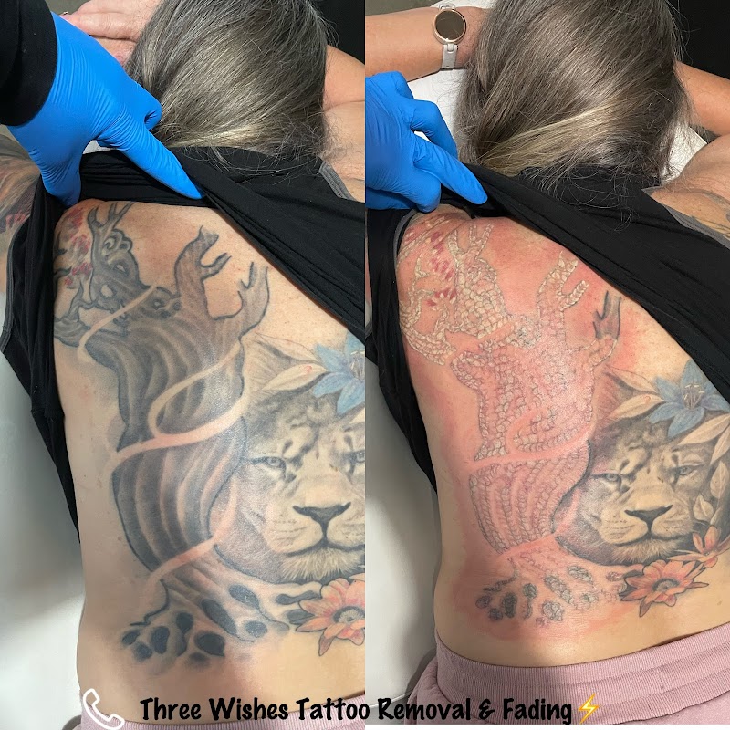 Northland Tattoo Removal — laser tattoo removal clinic in Whangārei