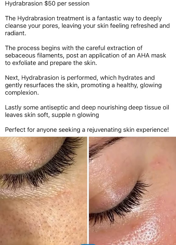 Amax Laser Clinic — laser tattoo removal clinic in Papatoetoe