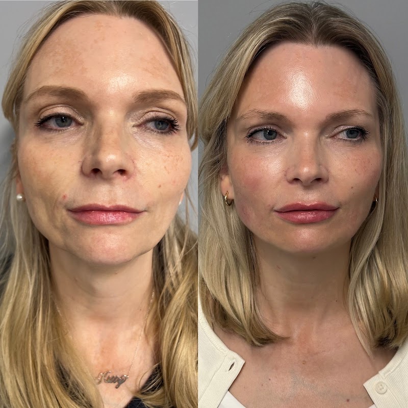 Theresa Wild Aesthetics Ltd (Canford Cliffs) — laser tattoo removal clinic in Poole