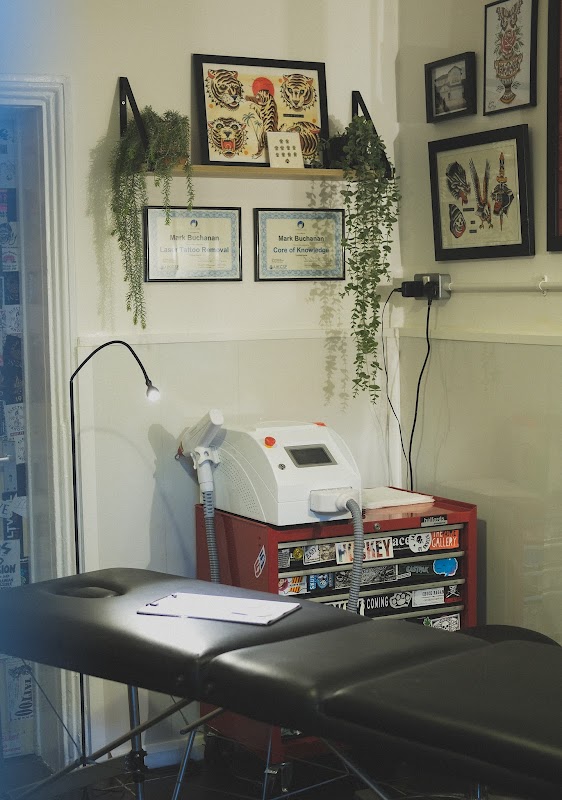 Farewell Tattoo Removal at Supertouch Tattoo — laser tattoo removal clinic in Whitley Bay
