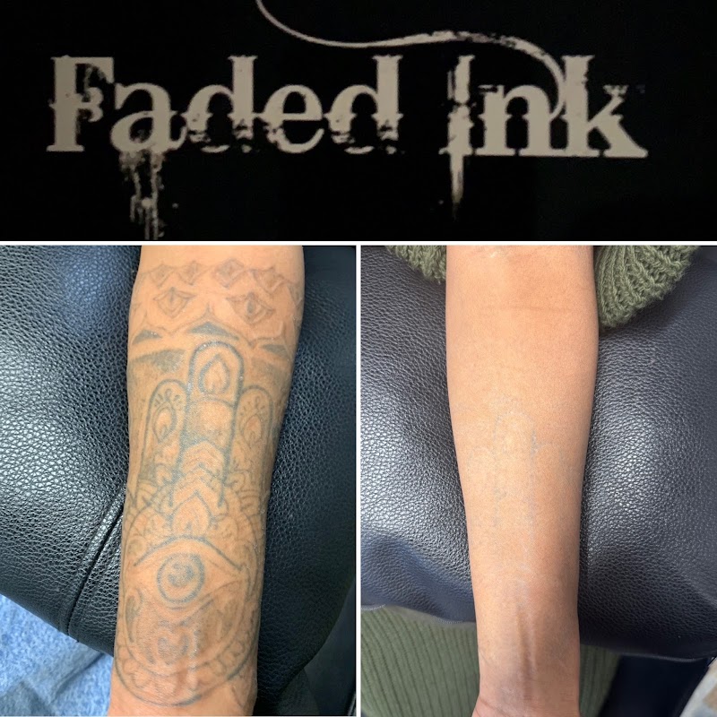 Faded-ink — laser tattoo removal clinic in Manchester
